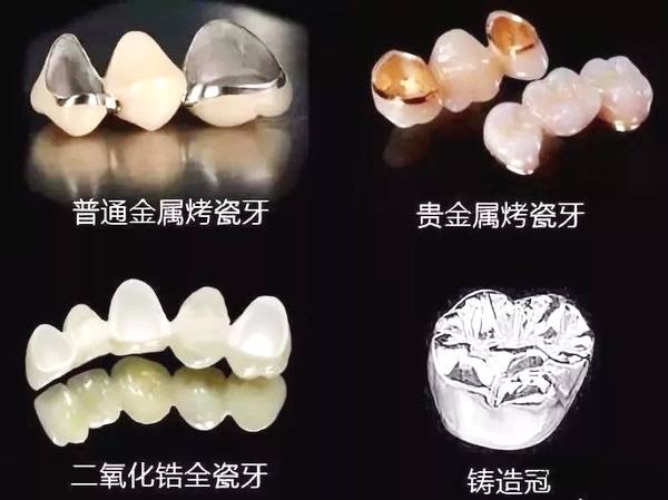 常德美奧口腔鉅惠看牙,韓國登騰種植牙3980元起,自鎖托槽矯正享5折優(yōu)惠！