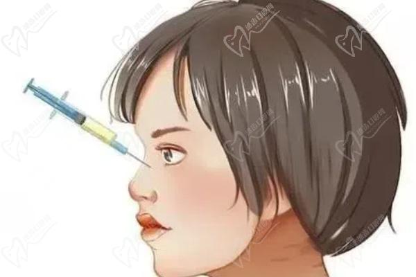 玻尿酸填充鼻子哪個(gè)牌子比較好？